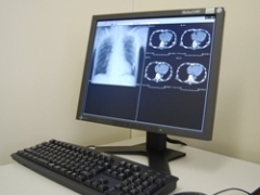 医用画像ネットワークシステムの画像